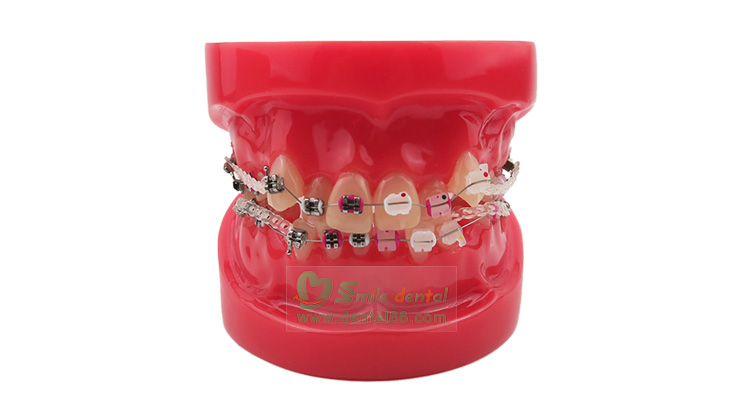 Orthodontic Model